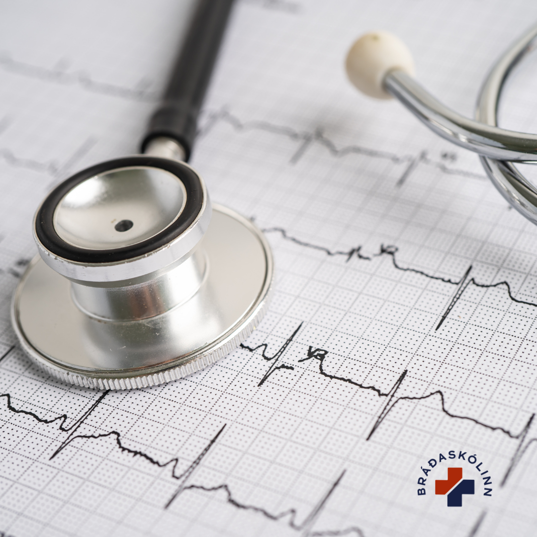 Hjartalínurit fyrir byrjendur